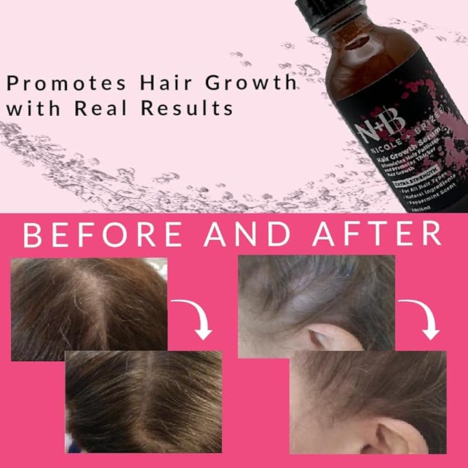 N+B Hair Growth Serum - Helps Promote Thicker, Fuller, & Healthier Hair w/Biotin, Natural-Based Formula, Helps Prevent Hair Fall & Thinning, For Women In All Hair Types - 2oz.