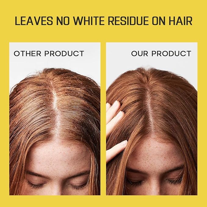 HALOVIDA Dry Shampoo for Women, No White Residue Instantly Fresh Shampoo Spray, Absorb oils, Refreshing Volumizing Hair Dry Shampoo 5.07 FL.OZ (Pack of 4)