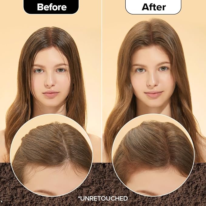 I DEW CARE Biotin Clarifying Dry Shampoo - Tap Secret Medium Brown | Strengthening & Volumizing, Powder Type, Refillable, Travel size, Non-aerosol, Brunette, Korean Ginseng, 0.25 Oz