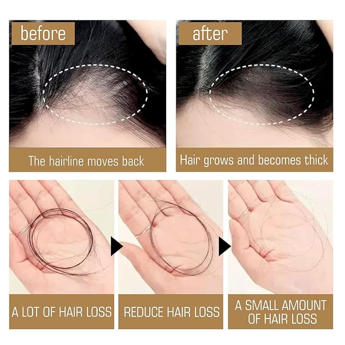 2 pcs Anti Hair Loss Shampoo,Anti-hair Fall Promote Hair Growth, Rich in Various Plant Extracts Shampoo,For All Hair Types,10.55fl oz (2pcs)