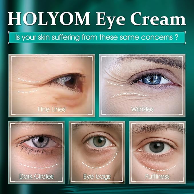 Advanced Eye Cream for Dark Circles - Rapid Under Eye Bags,Wrinkles, Puffiness Remover for Women and Men - Temporary Firming & Tightening Treatment - Wrinkle Filler 1 oz