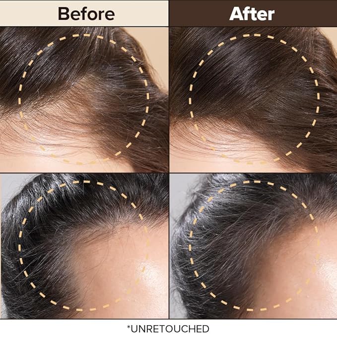 I DEW CARE Dry Shampoo Powder Set - Tap Secret Dark Brown + Refill | Strengthening & Volumizing, Powder Type, Refillable, Travel size, Non-aerosol, Brunette, Korean Ginseng, 0.26 Oz