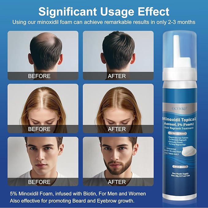 5% minoxidil foam for men, topical minoxidil foam, Biotin-Infused, Hair Growth Treatment, Unscented, Foam, 3-4 Month Supply, Supports Thicker and Fuller Hair & Beard