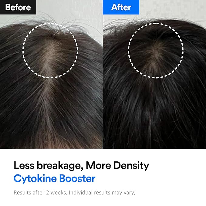 REFILLED Booster Plus Moisture | Hair Growth Serum & Thickening Scalp Treatment with Built-in Massager for Men & Women | Hair Loss & Thinning | Fuller & Baby Hair Regrowth | Fast-Absorbing with Biotin