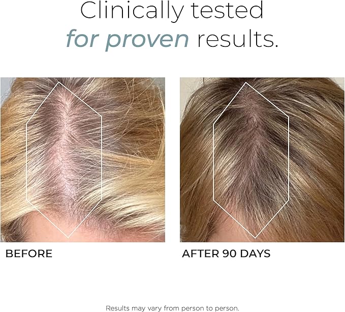 Hush & Hush DeeplyRooted Hair Supplement for Stronger, Healthier Hair - Collagen Hair Growth Pills for Men & Women - Biotin for Hair Loss - Hair Care for Thinning Hair & Hair Regrowth - 120 Capsules