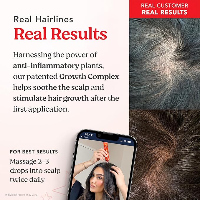 HAIRtamin Scalp Serum | Visibly Thicker, Nourished Hair and Healthy Scalp Treatment (Two Pack)